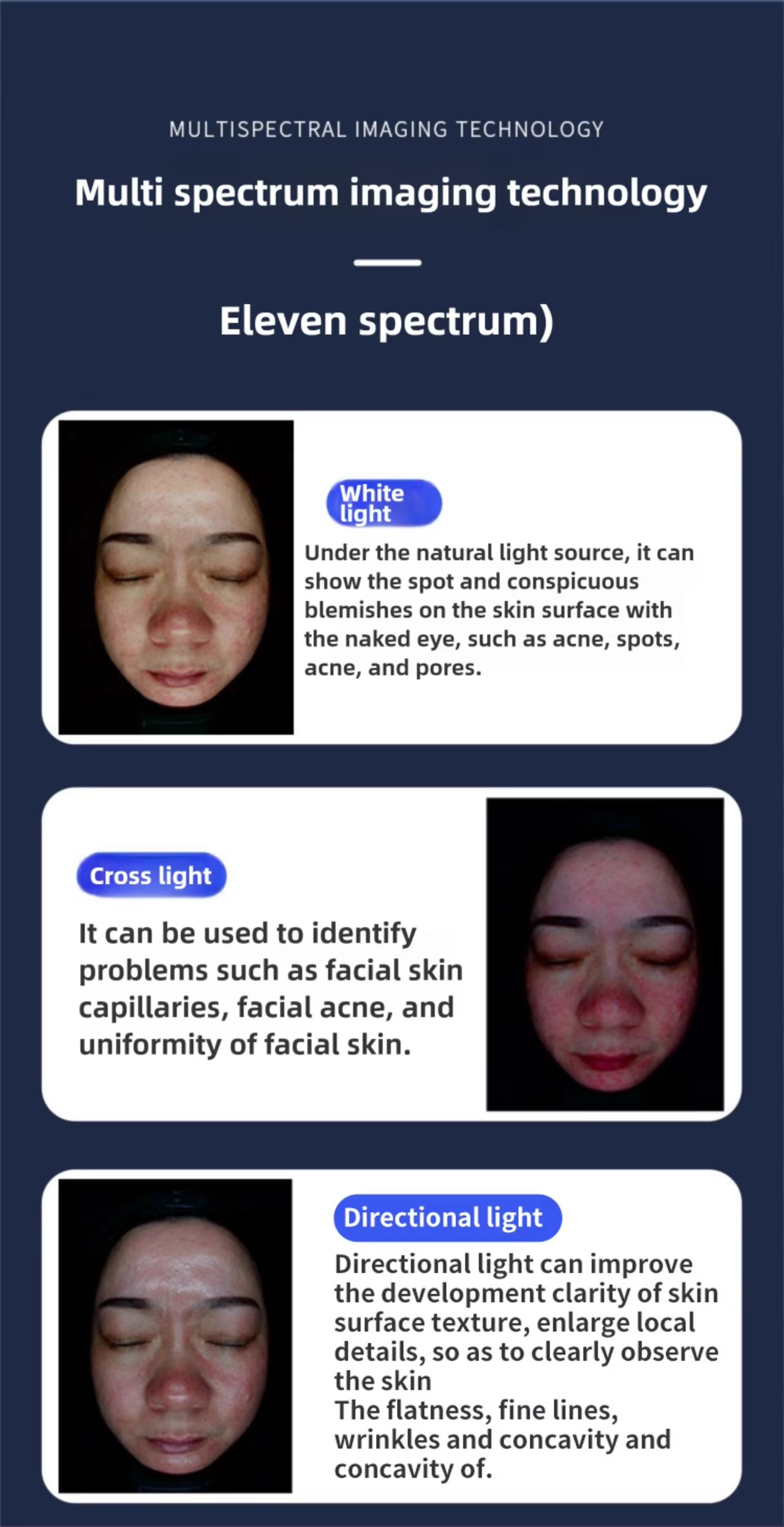 AI Skin Analysis Machine