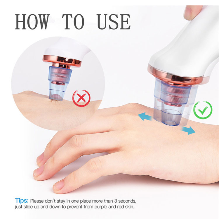 Blackhead Remover Results