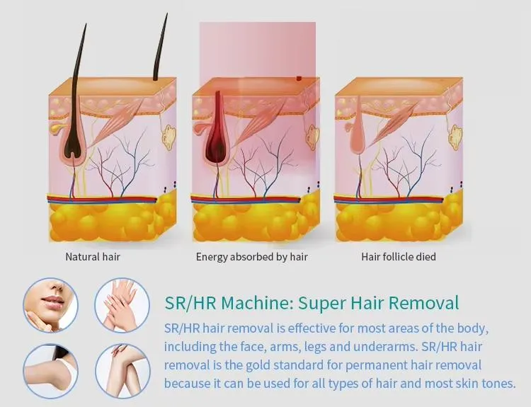 Super Hair Removal Tech