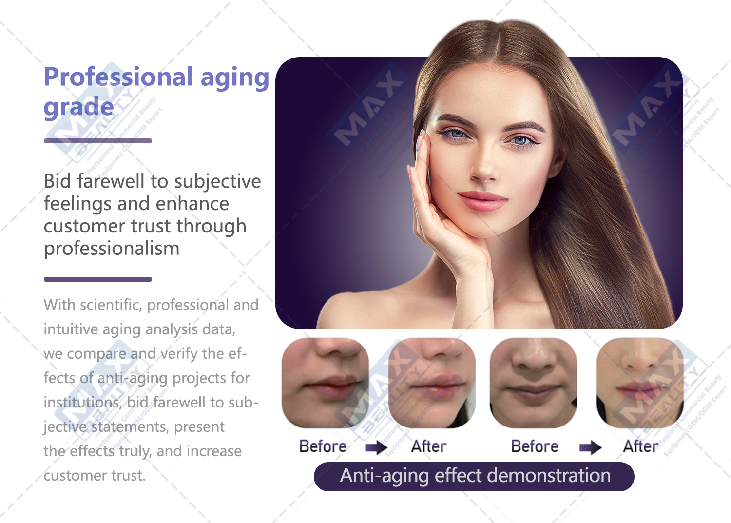 Skin Analyzer Image 4