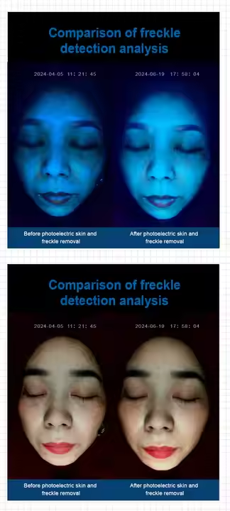 Skin Spectrum Analysis 5