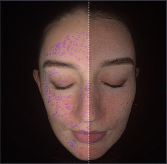 Pigment Prediction