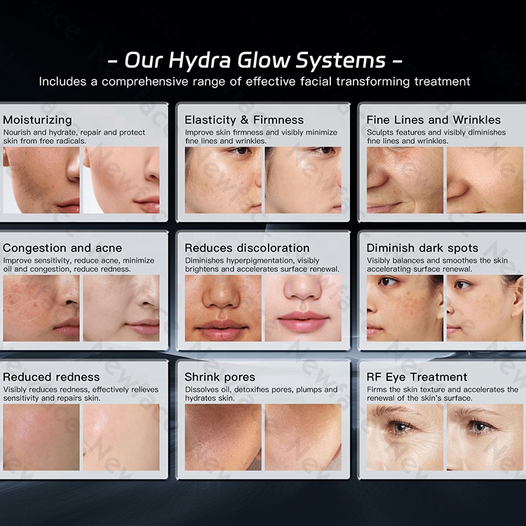 NewFace 2025 Professional Facial Machines Manufacturer Hydra Dermabrasion Oxygen Jet Skin Care Aqua Peel Hydro Beauty Machine