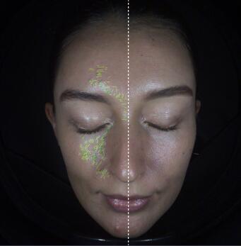 Wrinkles Predictions