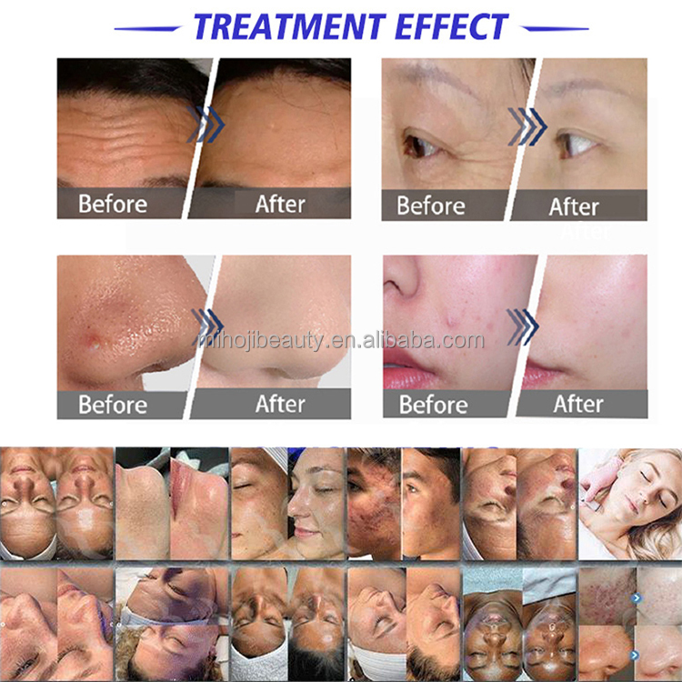 Facial Machine Features