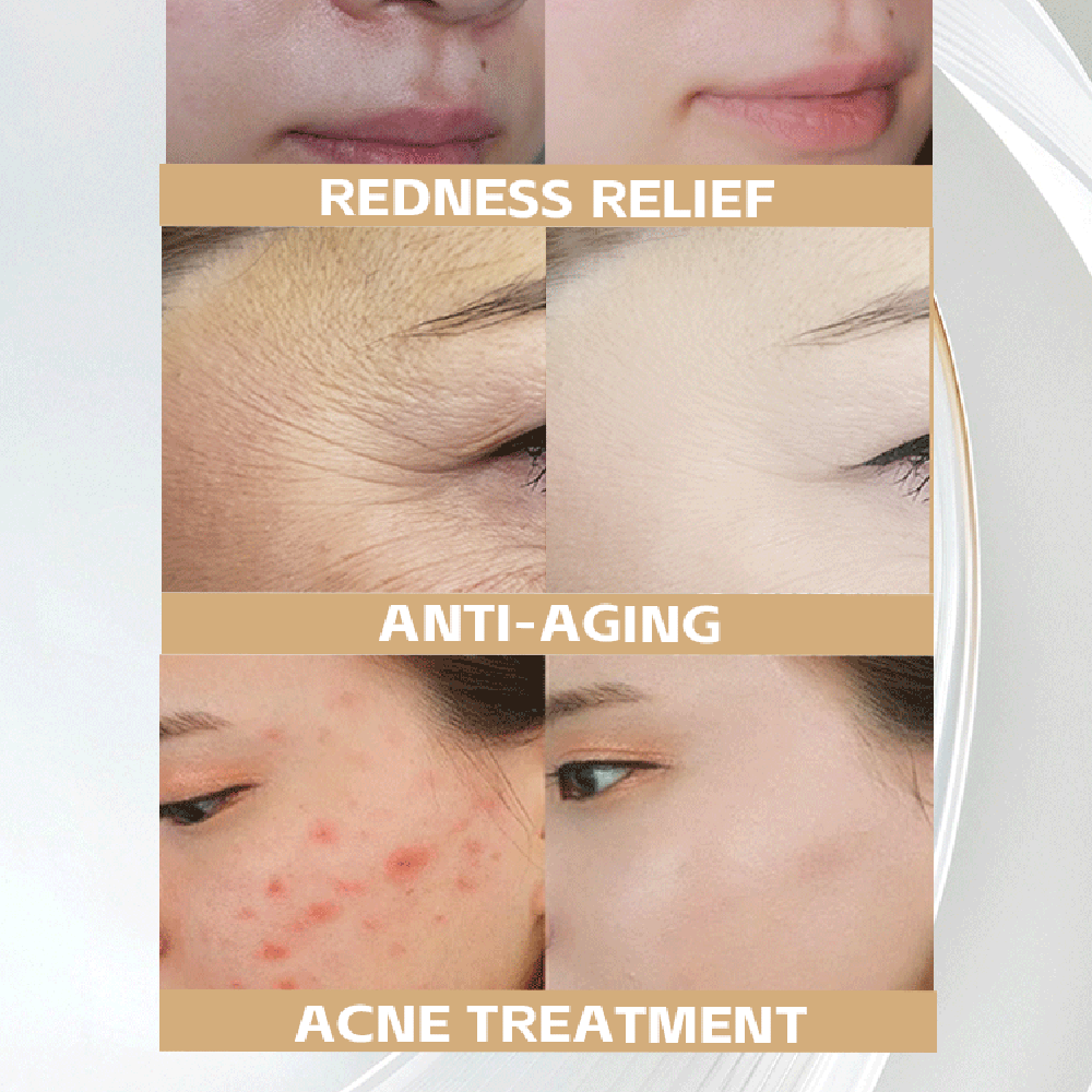 Face Lifting Massager Application