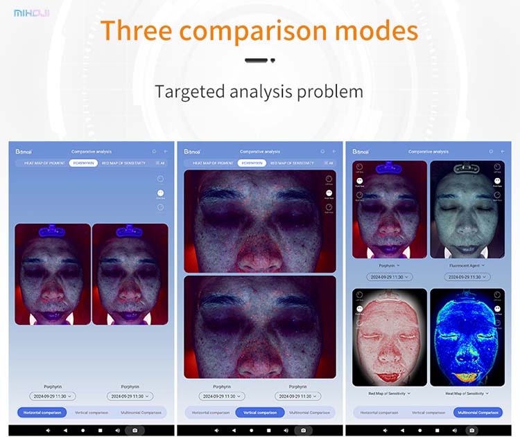 Skin Analyzer Detail 5