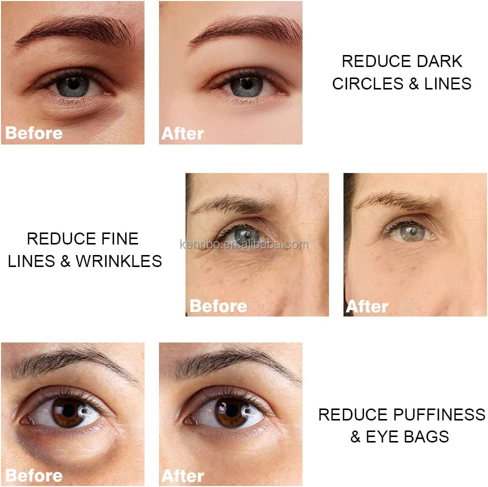 Using Effect After