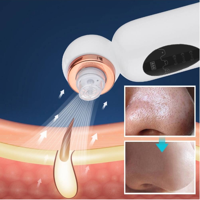New Arrival USB Rechargeable Blackhead Remover Bubble Facial Cleansing Machine Vacuum Pore Cleaner Head Skin Rejuvenation