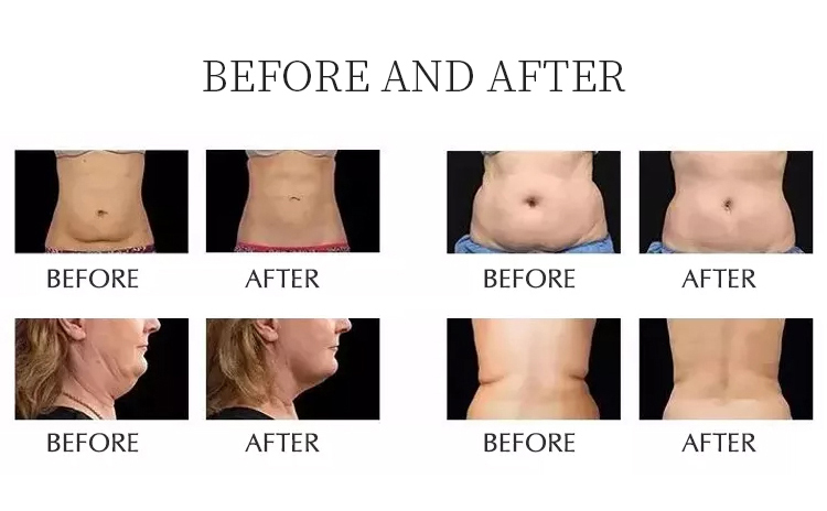 Before and After Results