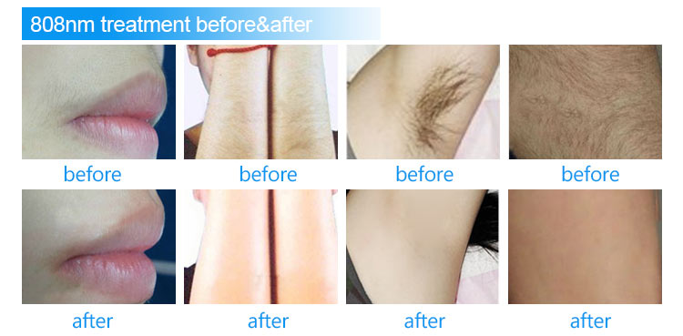 Before and After Results 3