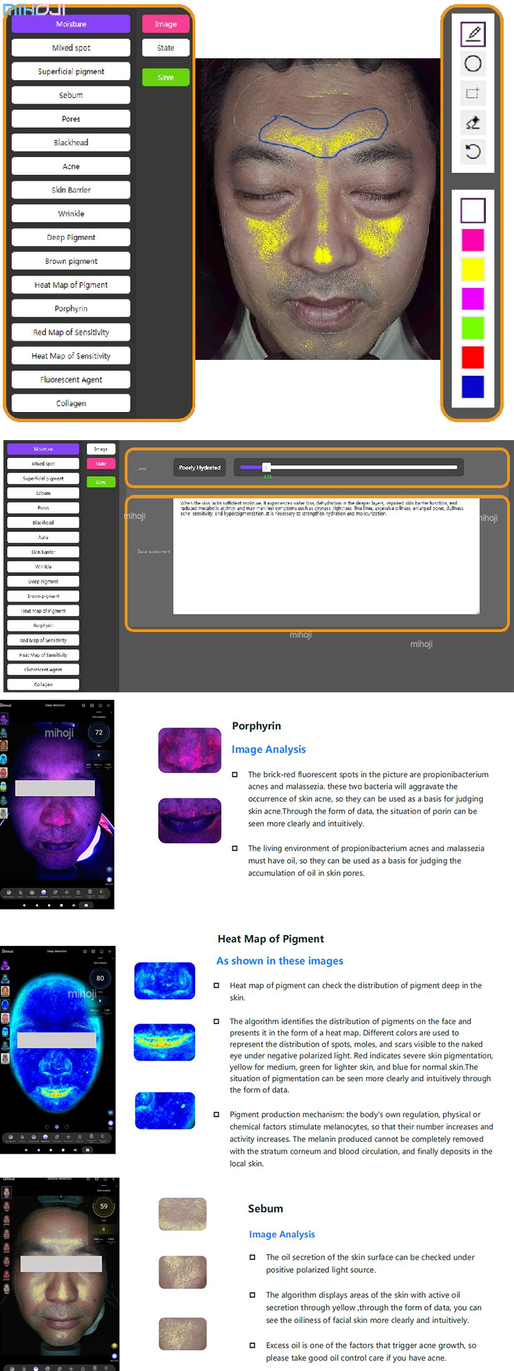 Skin Analysis Function 1