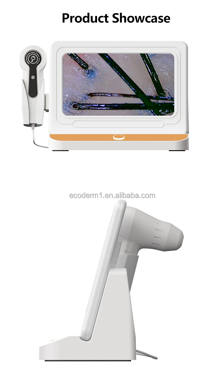 High Quality HD Massage Hair-loss Treatment Growth Smart Wireless Skin and Hair Analysis Machine AI Tester