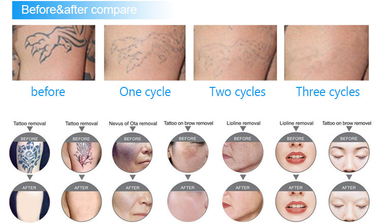 Before and After Results 2