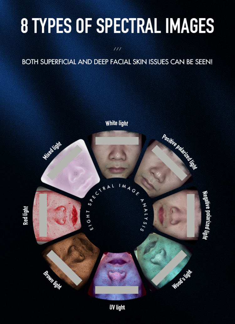 Skin Diagnosis Interface
