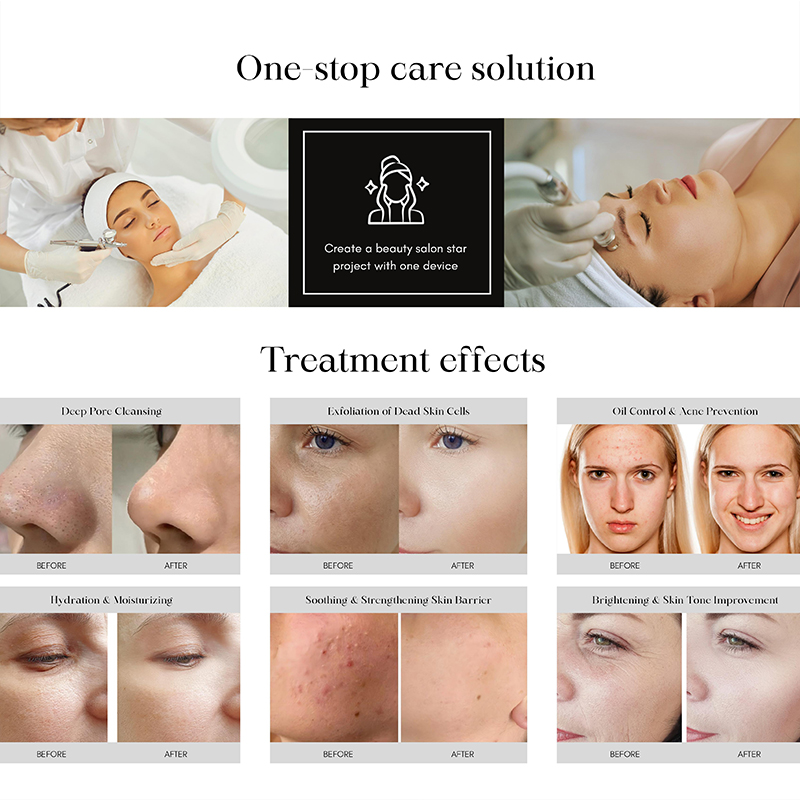Oxygen Jet Facial System: Deep Cleansing, Hydration, and Skin Barrier Strengthening