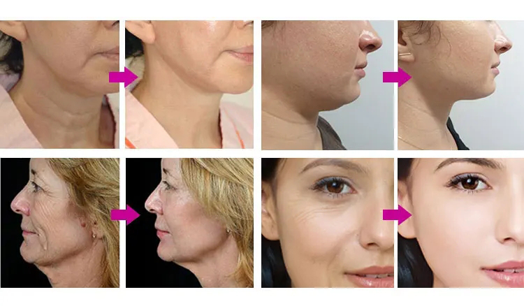 Before and After Treatment Results