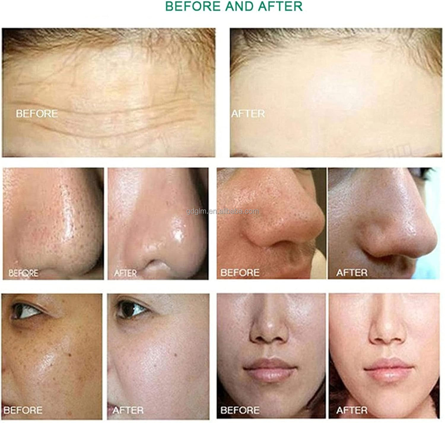 Spa 639 10in1 Multifunctional Beauty Spa Equipment Face Diamond Dermabrasion Skin Rejuvenation Machine