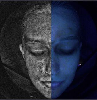 Black White Image and Deep Spot