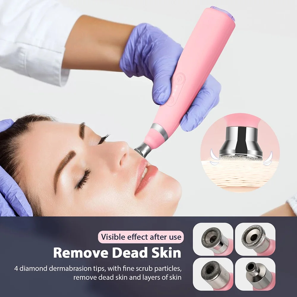 K Handheld 2 in 1 Wrinkle Removal Microdermabrasion Machine for Blackhead Removal Deep Cleansing Machine Dead Skin Removal