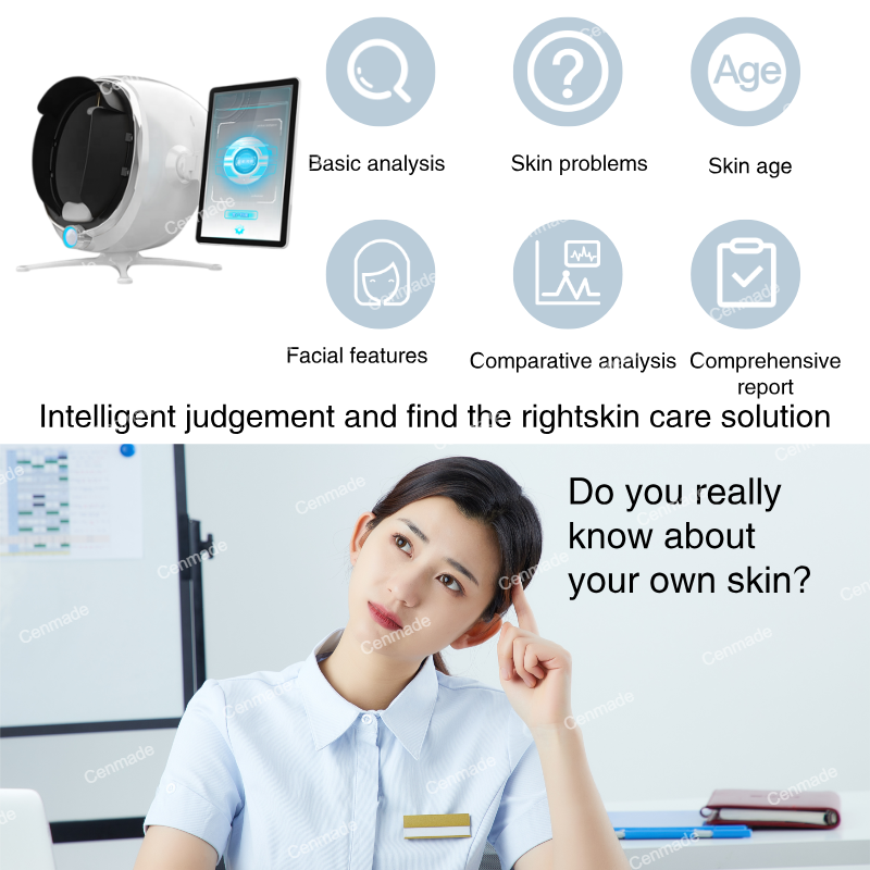 Analyzer feature 3