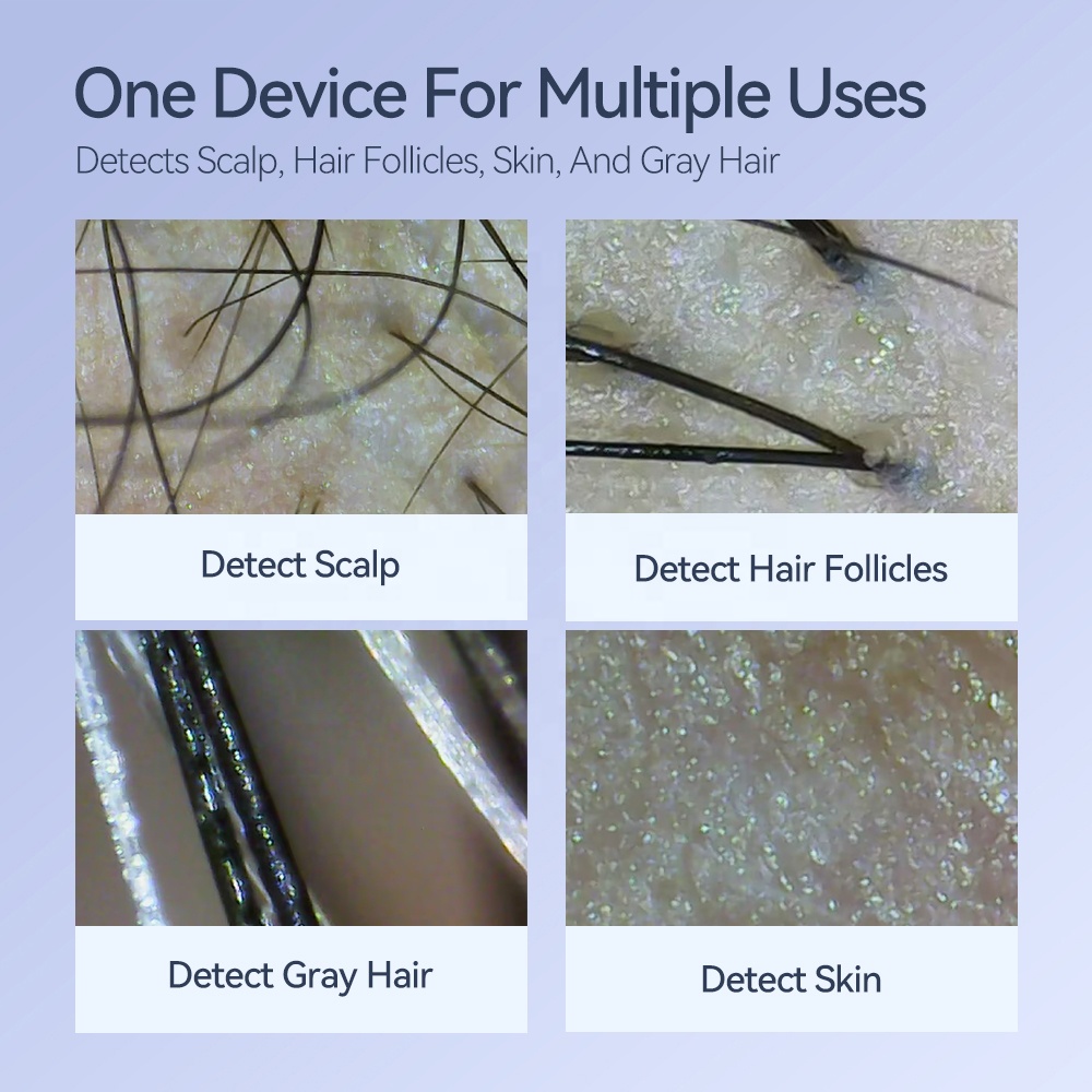 Kimairay Hair Growth Scalp Massage Therapy Machine Hair Skin Analyzer Hair Follicle Scanner Device