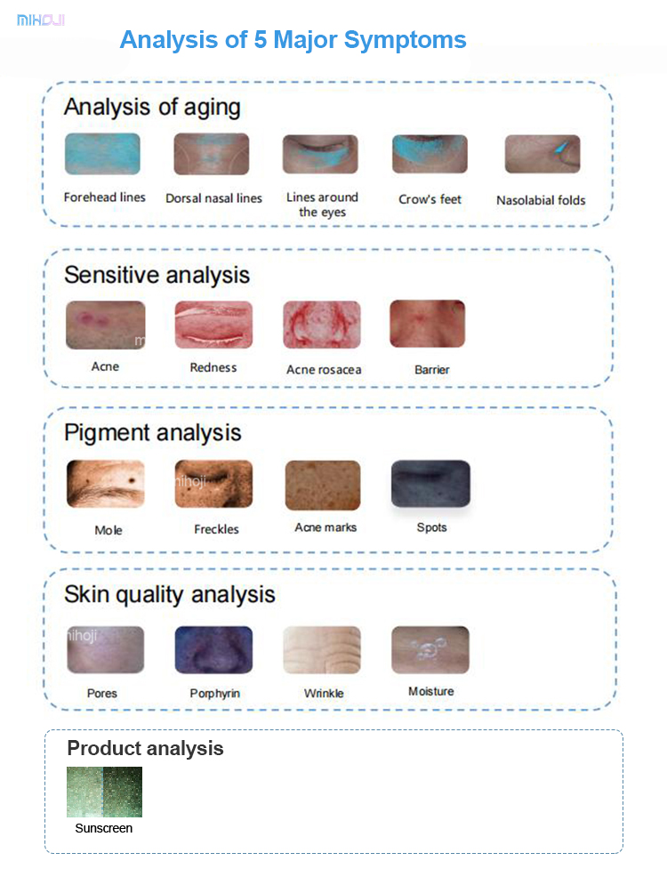 Skin Analyzer Detail 3