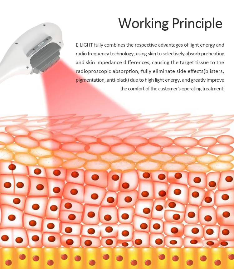 Medical CE Approved IPL Aesthetic Laser Hair Removal Elight Facial Permanent Hair Removal Machine