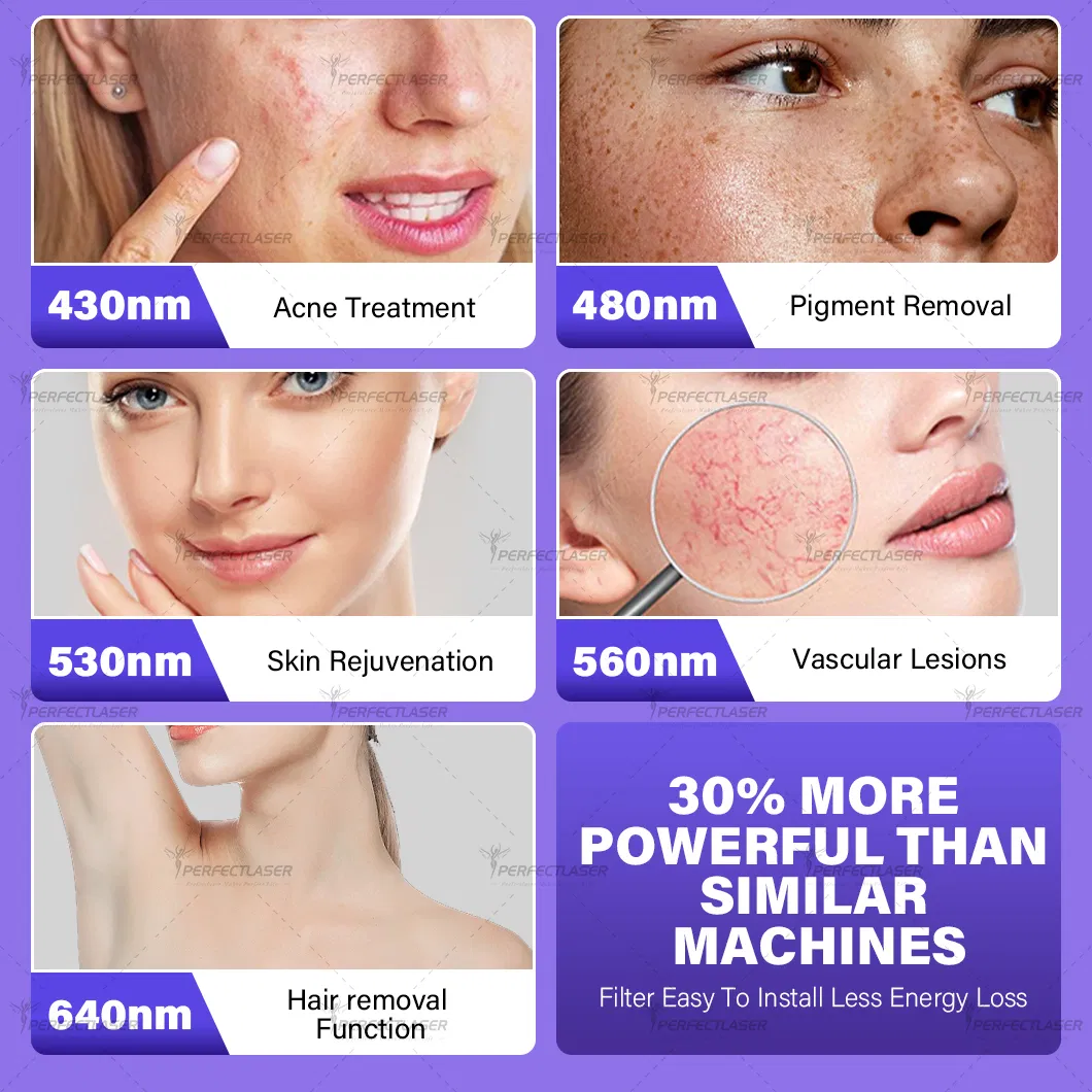 Diode Laser Handpiece Details