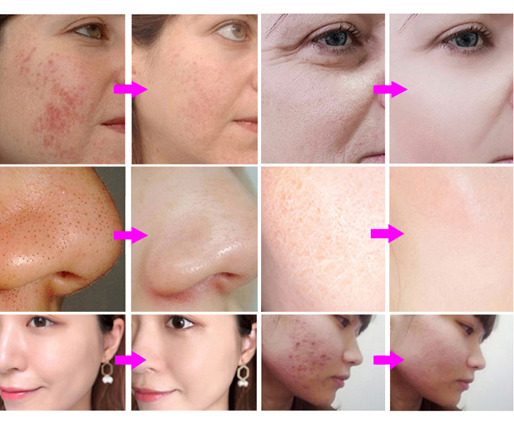 Before & After results