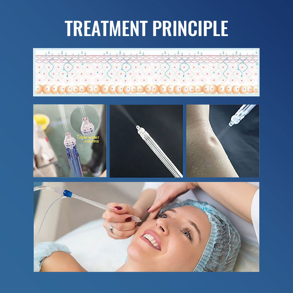 CE Approved Hydration Oxygen Aqua Jet Peel Machine Water Dermabrasion Facial Cleaner Professional Skin Care Spa Beauty Equipment