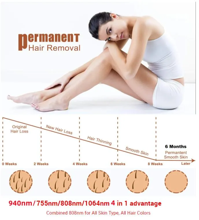 IPL Treatment Interface Parameters