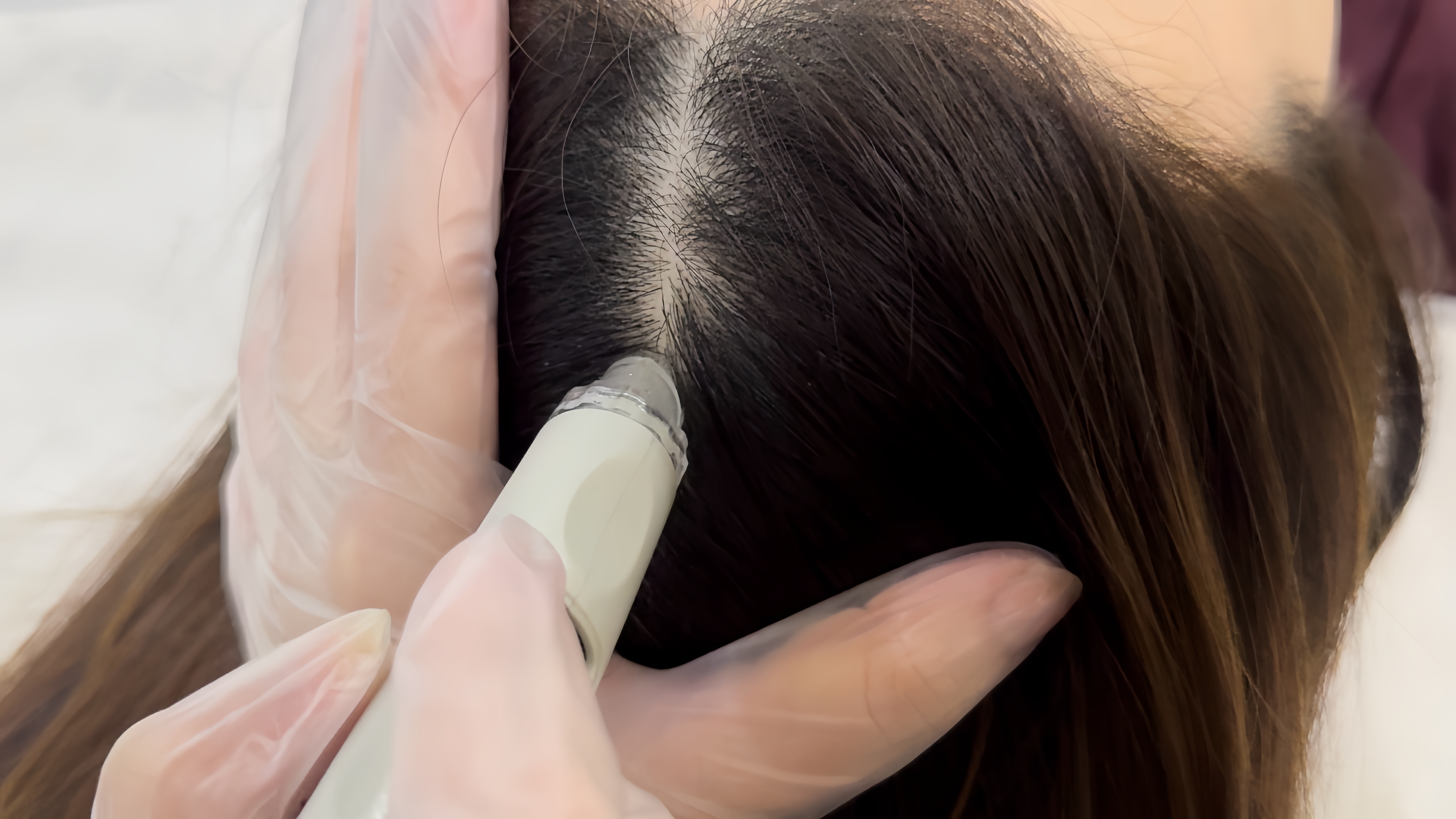 Deep Scalp Cleansing