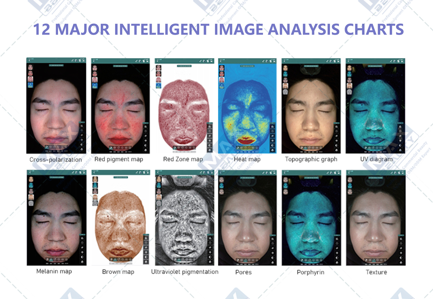 Skin Analyzer Image 9