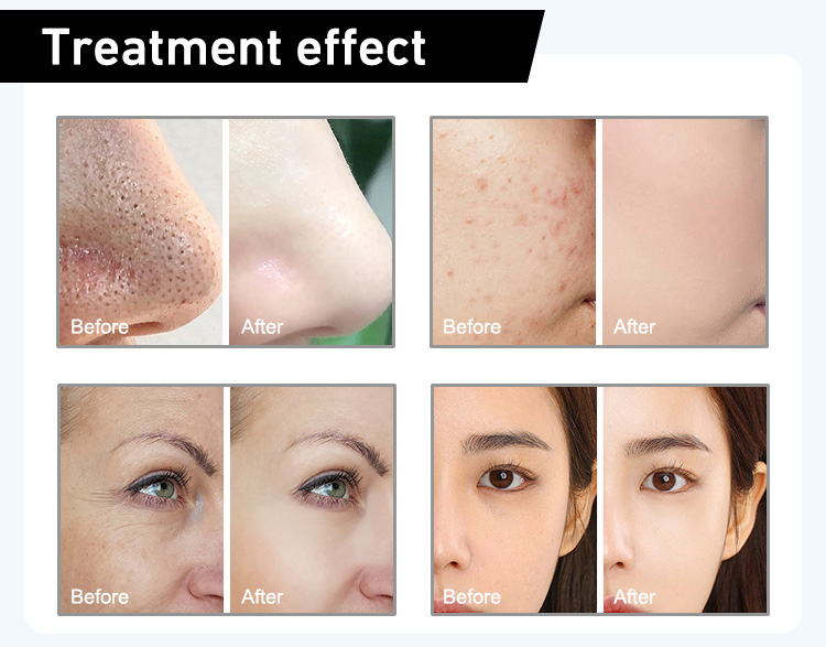 Product Description Image 7