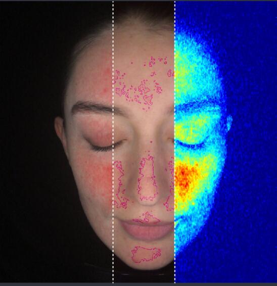 Red Pigment / Sensitive / 3D Heat