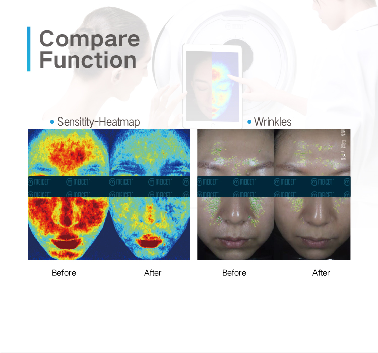 MC10 Full Face Scanner Skin Analyzer Equipment AI Technology for Facial Problems Analysis Moisturizer Features EU IT JP US ZA