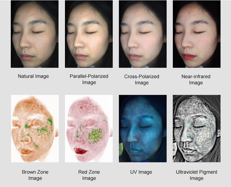 Intelligent Images Analysis