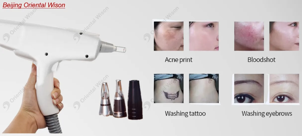 Diode Laser Hair Removal IPL Cell Light Skin Rejuvenation YAG Laser Tattoo Ink Pigment Removal RF Facial Lifting Body Slimming Skin Beauty Equipment