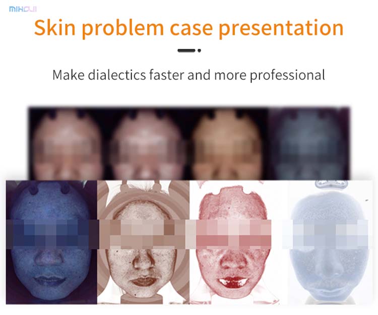 Skin Analyzer Detail 9