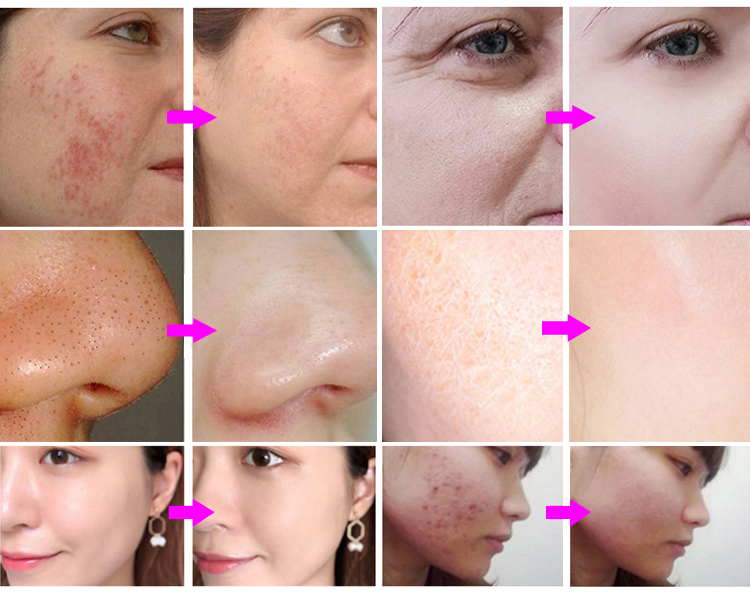 Treatment Results Before and After