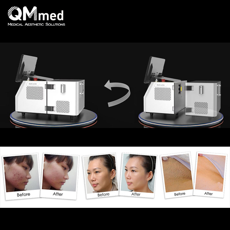 Professional IPL Photo Facial Machine Platform Sales Top 1 Best Permanent Electrolysis Hair Removal Machine Professional
