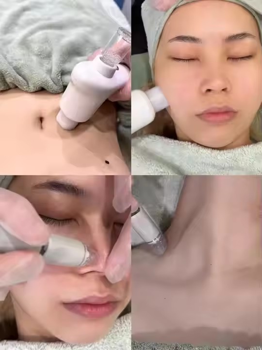 Deep Cleaning Treatment