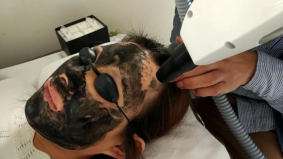 Opt IPL + Elight + RF + ND YAG Laser 4 in 1 Multifunction Facial Treatment