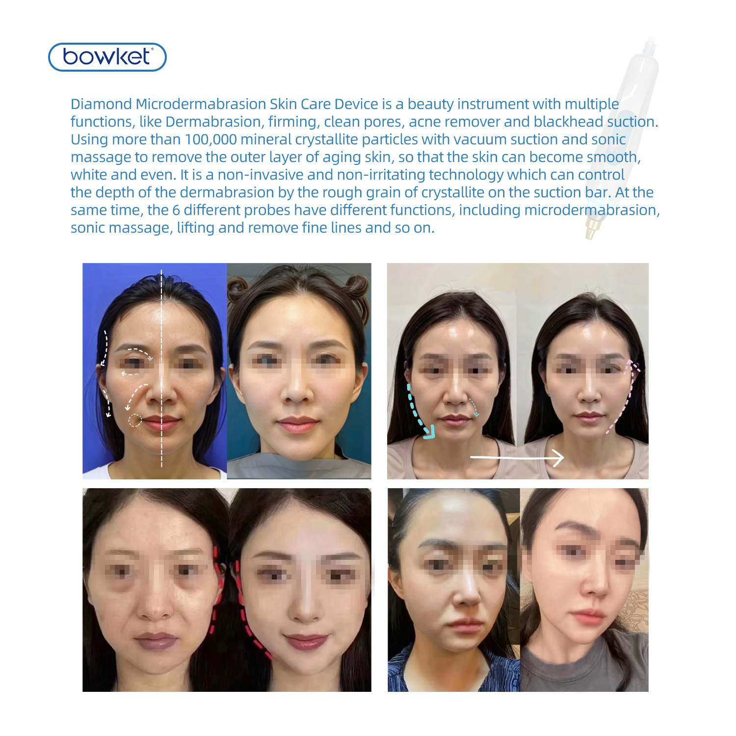 Diamond Microdermabrasion Machine Description 6