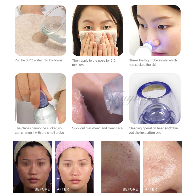 Vacuum Cleaner Pores Blackhead Remover Acne Pimple Removal Vacuum Suction Tool Face Clean Facial Diamond Dermabrasion Machine 5W