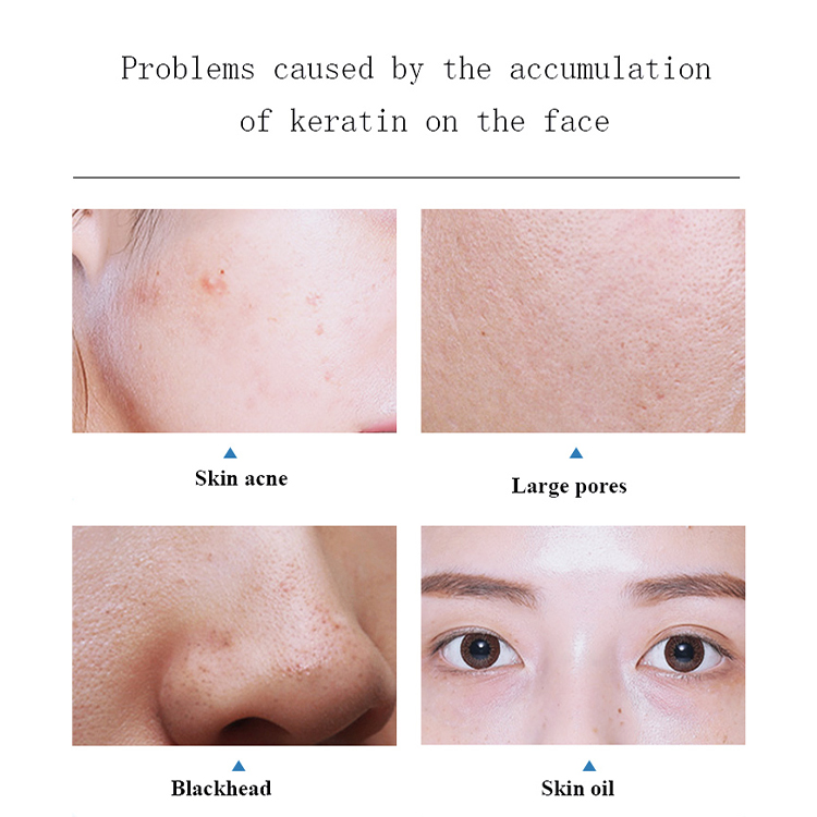Desktop 2-in-1 Vacuum Diamond Microdermabrasion Pore Cleansing Machine Skin Rejuvenation Eye Care All Skin IT/AU Compatible