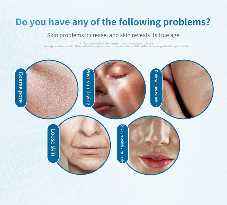 Cool Skin Tightening Machine Detail 9
