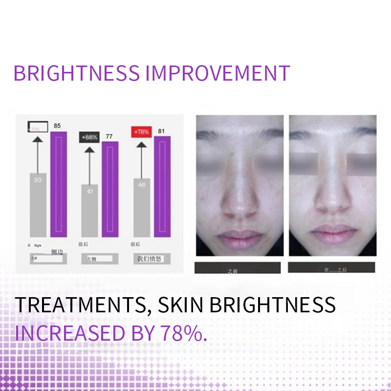 Ready To Ship NAD Plus Peptide Anti Aging NAD+ Skin Booster Care 100mg PDRN &amp; Nad+ Peptide Lyophilized Powder Vials Ampoule