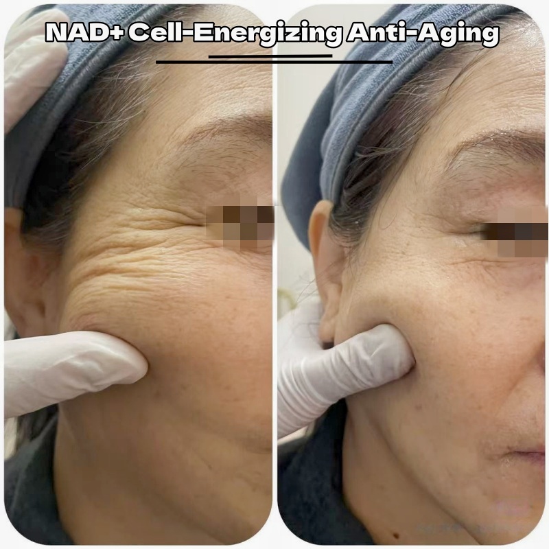 Ready To Ship NAD Plus Peptide Anti Aging NAD+ Skin Booster Care 100mg PDRN &amp; Nad+ Peptide Lyophilized Powder Vials Ampoule